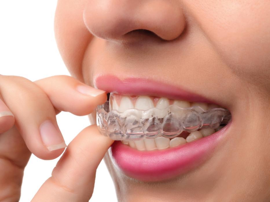 woman putting in invisalign in foothill ranch